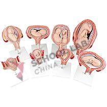 Period of Gestation Model Set